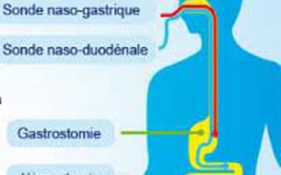 Présentation de l&rsquo;activité Nutrition