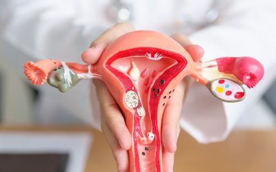 JDFC : La prise en charge douleur de l&rsquo;endométriose par NHC